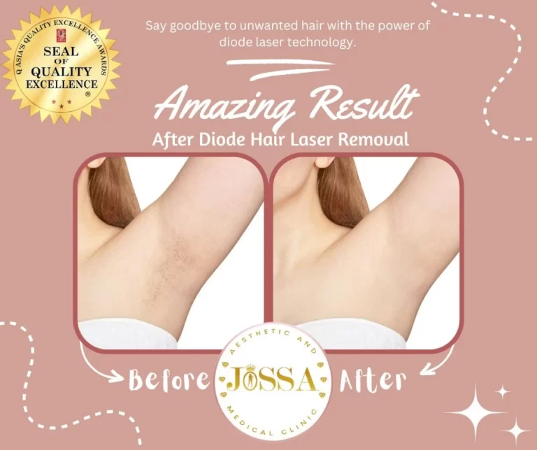 Permanent Laser Hair Removal Treatment Before and After