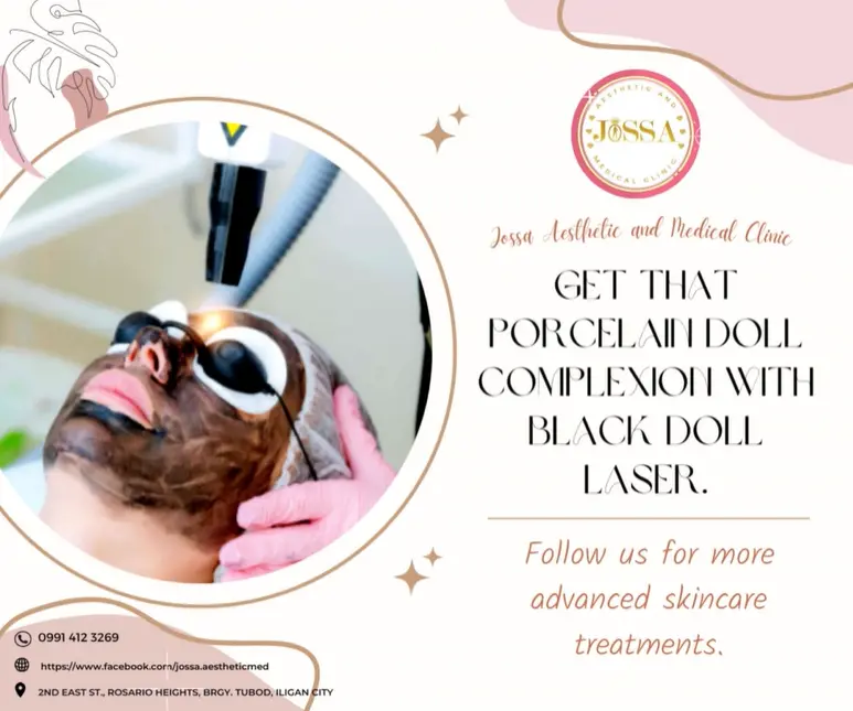 Laser Carbon Black Doll Treatment: Reveal Flawless Skin - Jossa ...